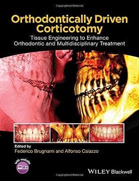 portada Orthodontically Driven Corticotomy: Tissue Engineering to Enhance Orthodontic and Multidisciplinary Treatment