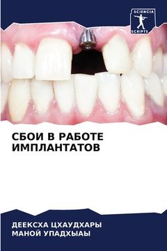 portada СБОИ В РАБОТЕ ИМПЛАНТАТО (en Ruso)