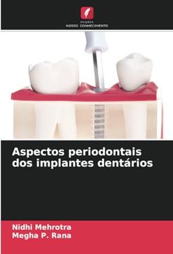 portada Aspectos Periodontais dos Implantes Dentários (en Portugués)