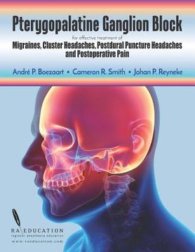 portada Pterygopalatine Ganglion Block: for effective treatment of Migraine, Cluster Headache, Postdural Puncture Headache & Postoperative Pain (en Inglés)