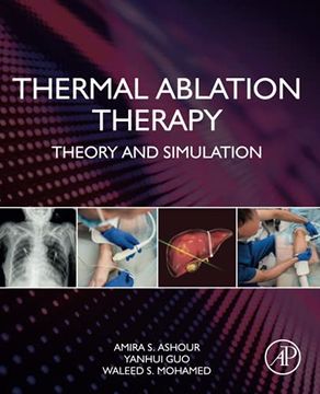 portada Thermal Ablation Therapy: Theory and Simulation (en Inglés)