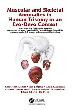 portada Muscular and Skeletal Anomalies in Human Trisomy in an Evo-Devo Context: Description of a t18 Cyclopic Fetus and Comparison Between Edwards (T18),. 3-d Imaging and Anatomical Illustrations (en Inglés)