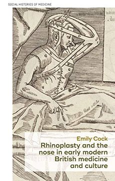 portada Rhinoplasty and the Nose in Early Modern British Medicine and Culture (Social Histories of Medicine) (en Inglés)