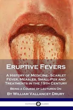 portada Eruptive Fevers: A History of Medicine - Scarlet Fever, Measles, Small-Pox and Treatments in the 19th Century - Being a Course of Lectu (en Inglés)