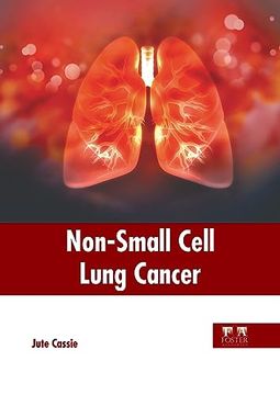portada Non-Small Cell Lung Cancer 