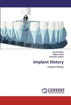 portada Implant History (en Inglés)
