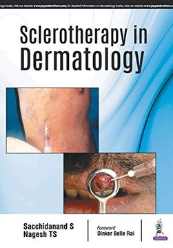 portada Sclerotherapy in Dermatology (en Inglés)
