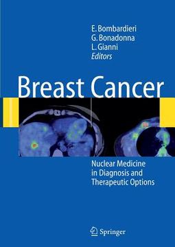 portada breast cancer: nuclear medicine in diagnosis and therapeutic options (en Inglés)