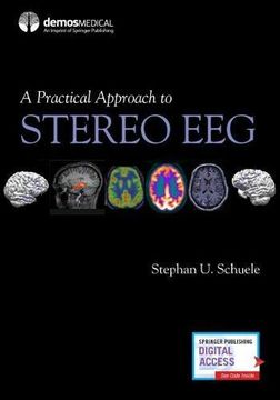 portada A Practical Approach to Stereo eeg (en Inglés)