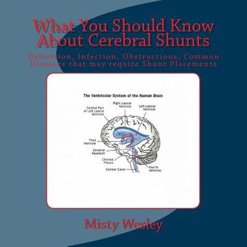 portada What You Should Know About Cerebral Shunts: Definition, Infection, Obstructions, Common Diseases that may require Shunt Placements (en Inglés)