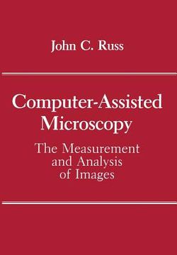 portada Computer-Assisted Microscopy: The Measurement and Analysis of Images