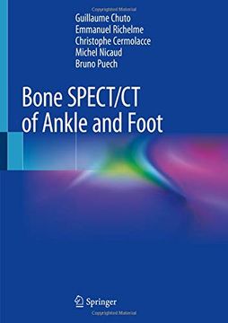 portada Bone Spect/CT of Ankle and Foot