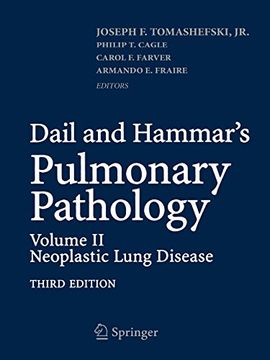 portada Dail and Hammar's Pulmonary Pathology: Volume ii: Neoplastic Lung Disease (en Inglés)
