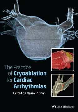 portada The Practice of Catheter Cryoablation for Cardiac Arrhythmias (en Inglés)