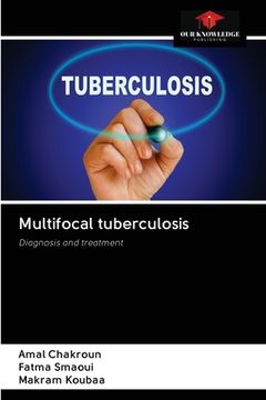 portada Multifocal tuberculosis (en Inglés)