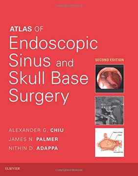 portada Atlas of Endoscopic Sinus and Skull Base Surgery, 2e (en Inglés)