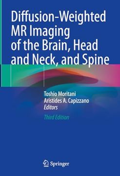 portada Diffusion-Weighted MR Imaging of the Brain, Head and Neck, and Spine (in English)