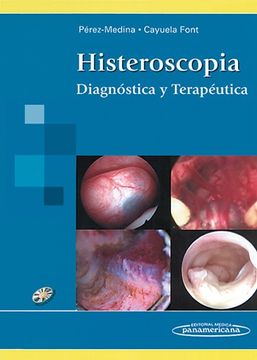 portada Histeroscopia: Diagnóstica y Terapéutica
