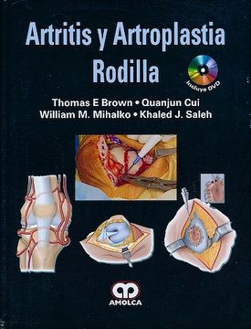 portada Artritis y Artroplastia de Rodilla