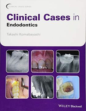 portada Clinical Cases in Endodontics (Clinical Cases (Dentistry)) (in English)