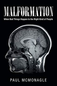 portada Malformation: When bad Things Happen to the Right Kind of People (en Inglés)