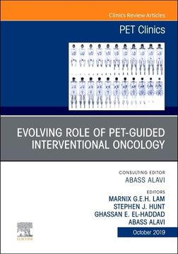portada Evolving Role of Pet-Guided Interventional Oncology, an Issue of pet Clinics (Volume 14-4) (The Clinics: Radiology, Volume 14-4) (en Inglés)