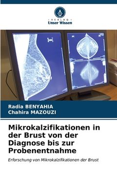 portada Mikrokalzifikationen in der Brust von der Diagnose bis zur Probenentnahme (en Alemán)