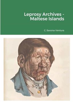portada Leprosy Archives - Maltese Islands (in English)