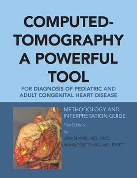 portada Computed-Tomography a Powerful Tool for Diagnosis of Pediatric and Adult Congenital Heart Disease: Methodology and Interpretation Guide (en Inglés)