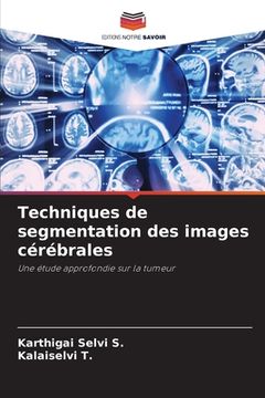portada Techniques de segmentation des images cérébrales (en Francés)