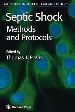portada septic shock methods and protocols (en Inglés)