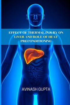 portada Effect of thermal injury on liver and role of heat preconditioning (en Inglés)