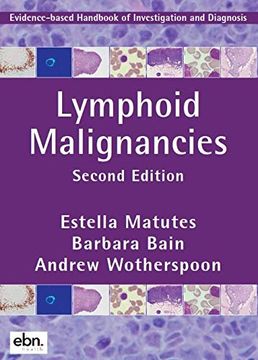 portada Lymphoid Malignancies: Evidence-Based Handbook of Investigation and Diagnosis 