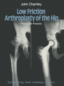 portada low friction arthroplasty of the hip: theory and practice (en Inglés)