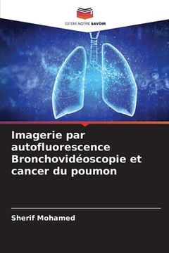 portada Imagerie par autofluorescence Bronchovidéoscopie et cancer du poumon (en Francés)