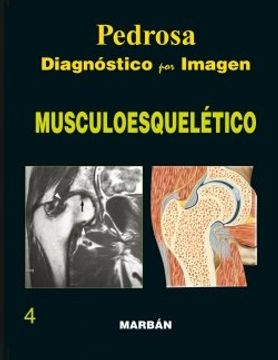 portada diagnostico por imagen musculoesquelético gran formato (in Spanish)