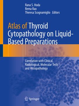 portada Atlas of Thyroid Cytopathology on Liquid-Based Preparations: Correlation with Clinical, Radiological, Molecular Tests and Histopathology (in English)
