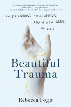 portada Beautiful Trauma: An Explosion, an Obsession, and a New Lease on Life (in English)