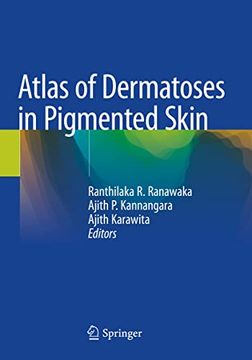 portada Atlas of Dermatoses in Pigmented Skin (en Inglés)