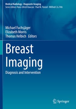 portada Breast Imaging: Diagnosis and Intervention (en Inglés)