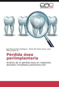 portada Pérdida ósea periimplantaria: Análisis de la pérdida ósea en implantes dentales inmediatos postextracción (Spanish Edition)