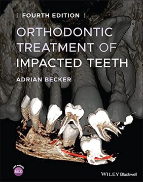 portada Orthodontic Treatment of Impacted Teeth