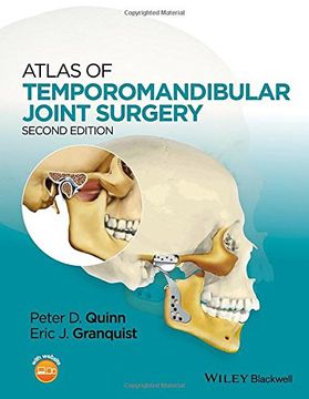 portada Atlas of Temporomandibular Joint Surgery