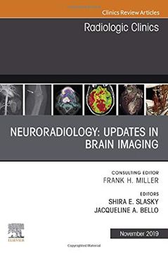 portada Neuroradiology, an Issue of Radiologic Clinics of North America, 1e (The Clinics: Radiology) (en Inglés)