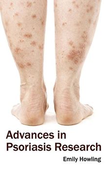 portada Advances in Psoriasis Research