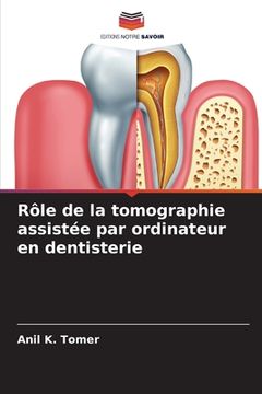 portada Rôle de la tomographie assistée par ordinateur en dentisterie (en Francés)