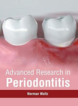 portada Advanced Research in Periodontitis (en Inglés)