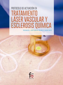 portada Protocolo de Actuación en el Tratamiento Láser Vascular y Esclerosis Química (Ciencias Sanitarias) (in Spanish)