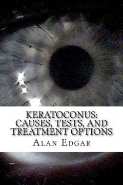 portada Keratoconus: Causes, Tests, and Treatment Options (en Inglés)