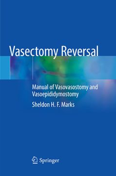 portada Vasectomy Reversal: Manual of Vasovasostomy and Vasoepididymostomy (en Inglés)